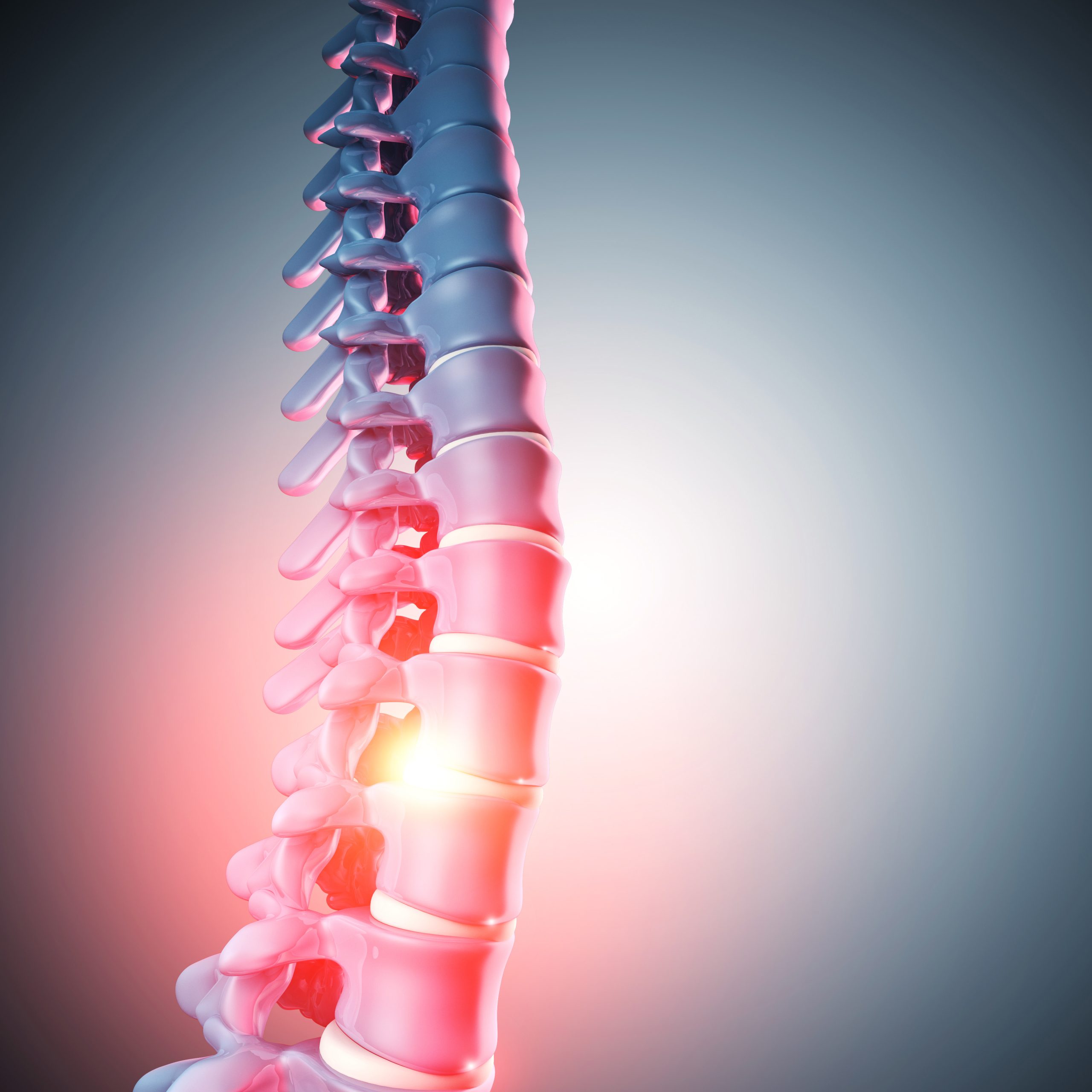 Fixing a Painful Bulging Spinal Disk in Your Back in Glendale, AZ ...