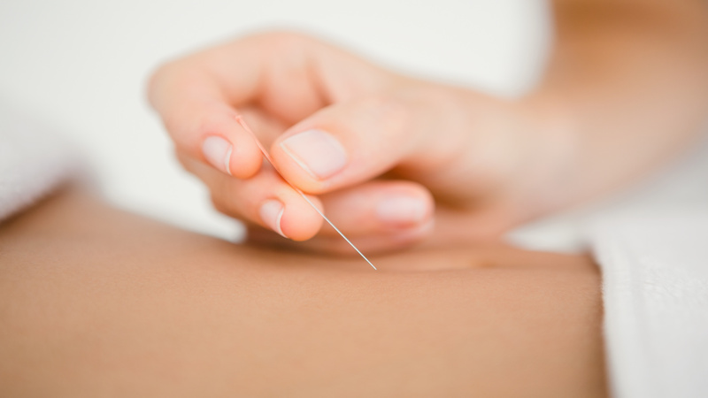 Relieve Daily Tension With Acupuncture For Stress Union City CA Residents Trust Most