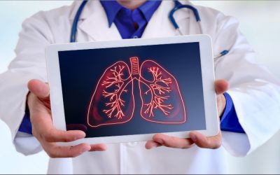 Patients Trust Pulmonary Clinic in Murrieta, CA, for Advanced Breathing Solutions Every Day